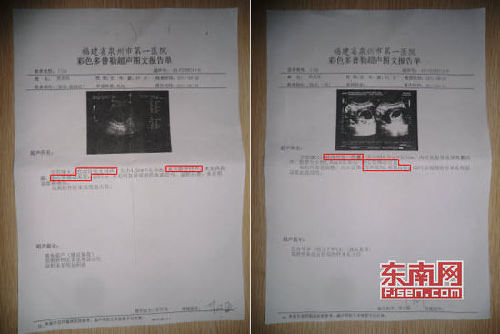 泉州第一醫院彩超錯判“胎死腹中”